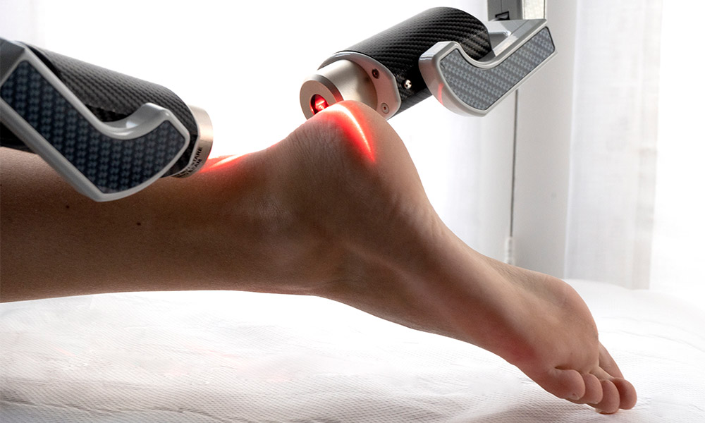 Talon-y-pie-1-1000 laser pie dolor